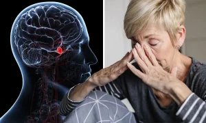 خطر آنوریسم مغزی