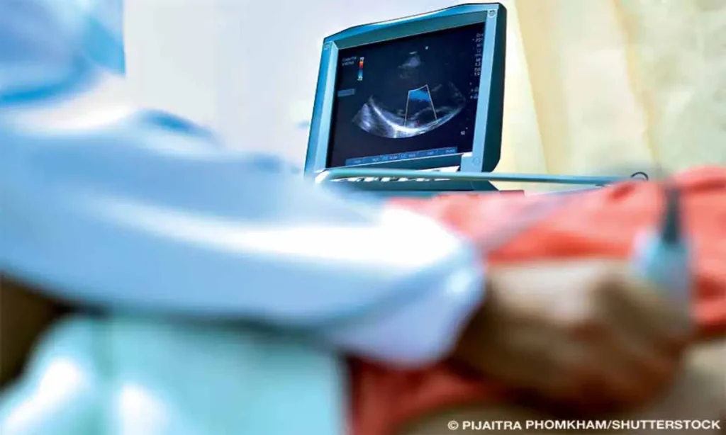 اکوکاردیوگرافی چیست