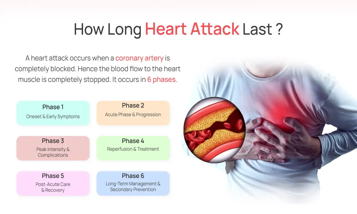 درد حمله قلبی چقدر طول می کشد؟