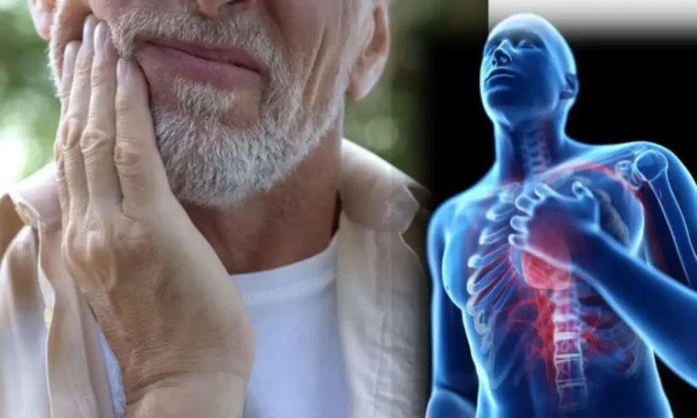 درد فک در حمله قلبی