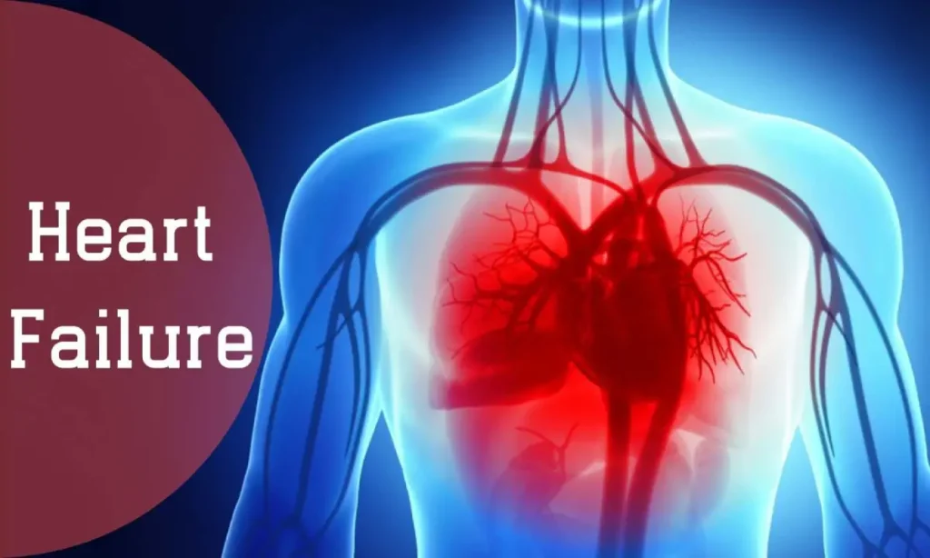 نارسایی قلب